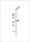 DRD2 Antibody (C-term)